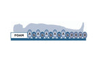 Sensaflo Hybrid Replacement System image 6